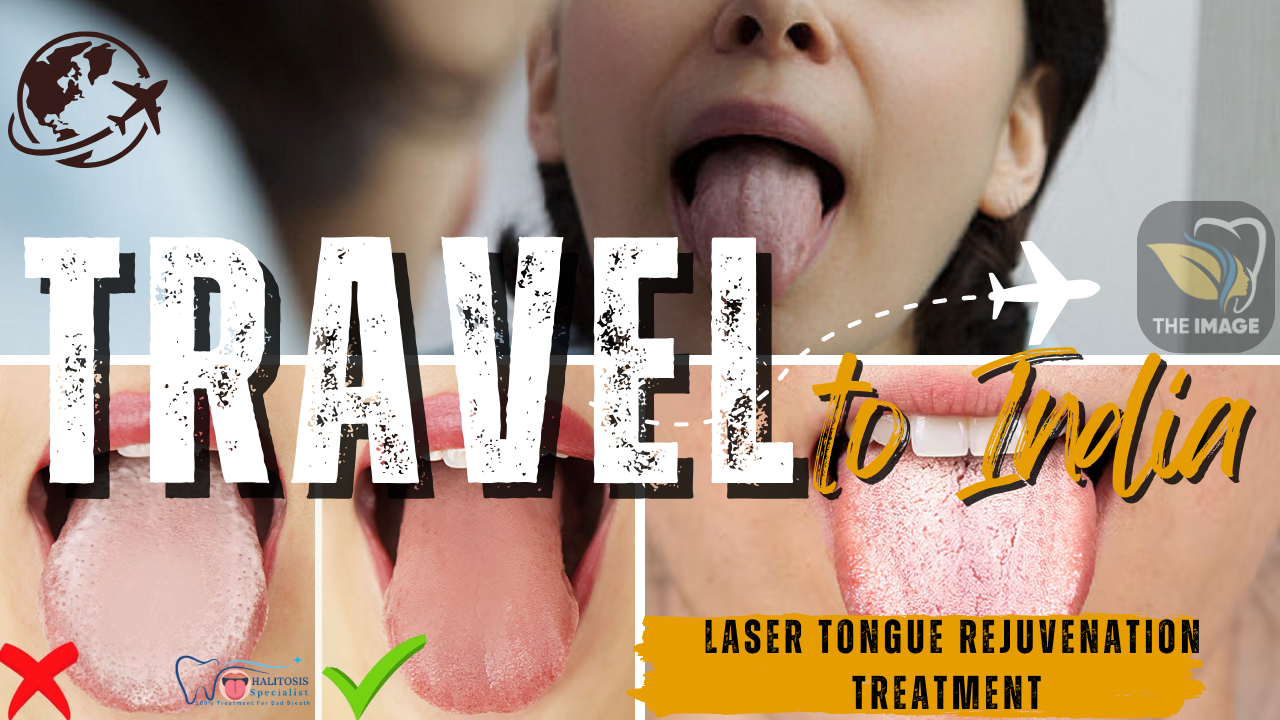 laser tongue rejuvenation 2